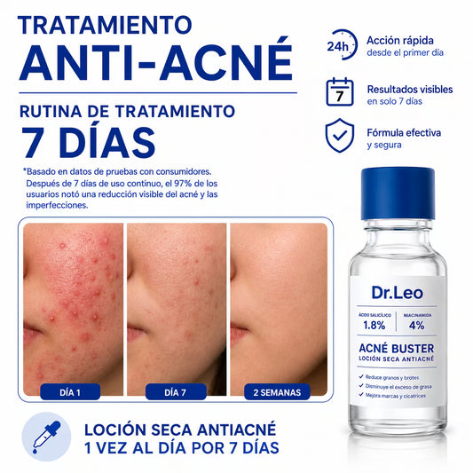 Tratamiento Acné Buster - Combate brotes, espinillas, granos y todo tipo de acné - 20 mL