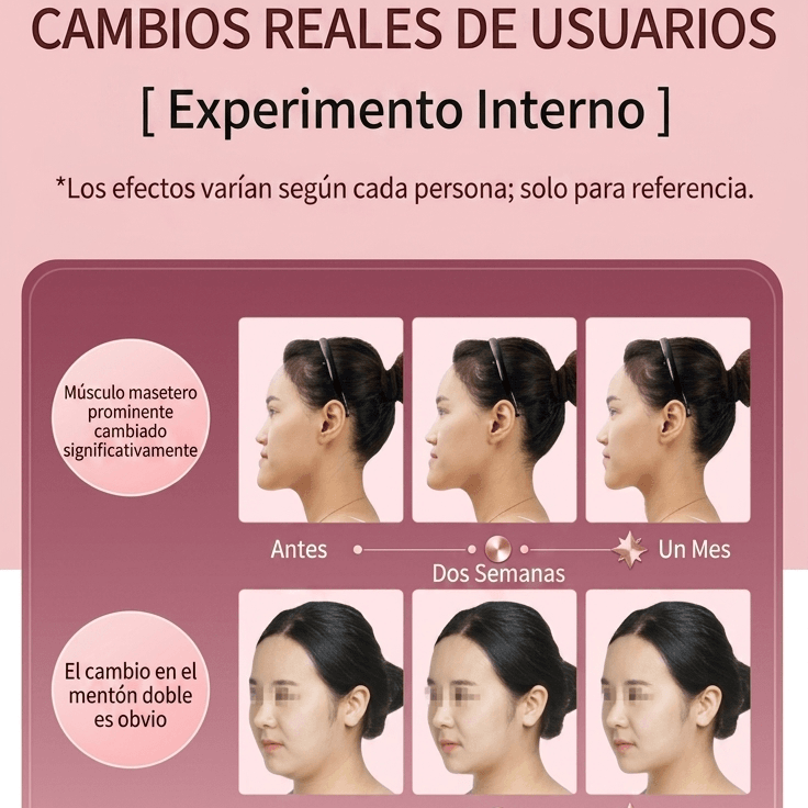 Dispositivo Reductor De Papada con Terapia de Fotones LED – Ideal para Lifting Facial, Moldeador y Adelgazamiento de papada