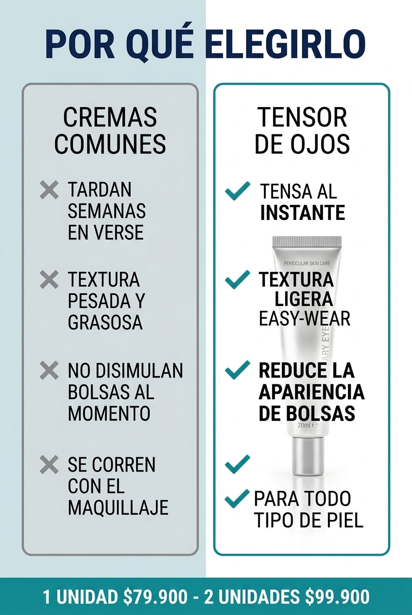 Por qu&eacute; elegirlo